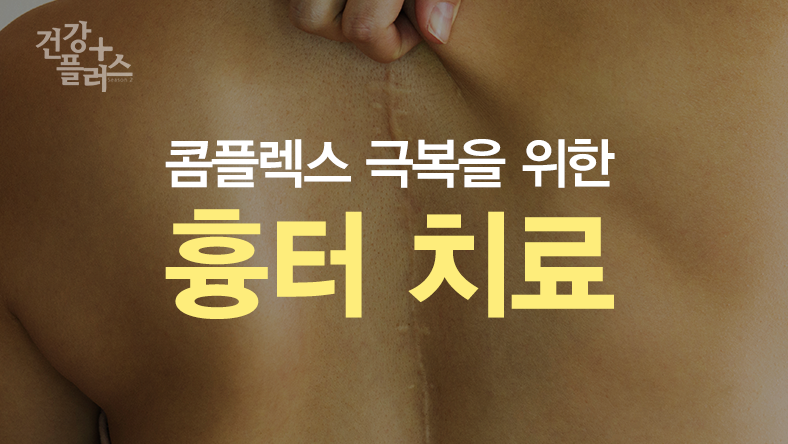 콤플렉스 극복을 위한 흉터 치료