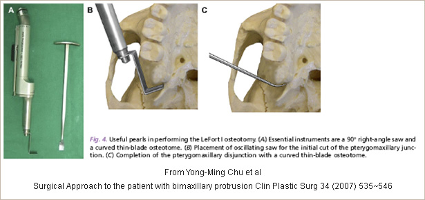 Indication of surgery