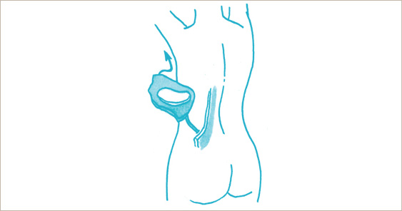 Latissimus dorsi musculocutaneous flap Perforator flap